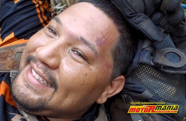 siniak po lewej stronie czoła od uderzenia