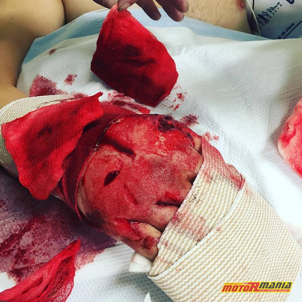 Sonny Dee w szpitalu (1)